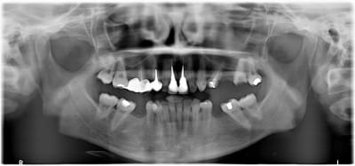 W2rvkyvqzmhze7jk3uty - Eugenol