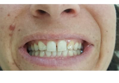 Wc1ciyhdsmzxoknoa5sh - Eugenol