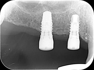 Wdwf6ypjjtvhqkbkg4jihlud8lap - Eugenol