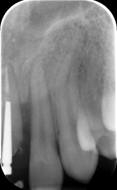Wrt8xvetqcn4ripru67k - Eugenol