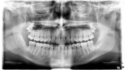 Xdcpgauvhsdhivb8dzk5 - Eugenol