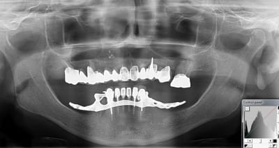 Xlmphktwoxvc0mocy611 - Eugenol