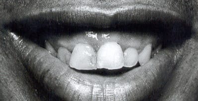 Xxx lgfa4r - Eugenol