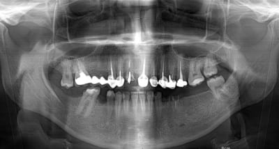 Y px0 0 ushnfv - Eugenol