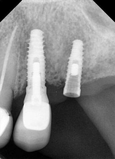 Ymuk3eymx26b8xsjq08c - Eugenol