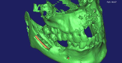 Youssouf  3d1 lagpzi - Eugenol