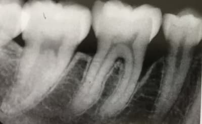 Yvk66zxmitblkjvbzopk - Eugenol