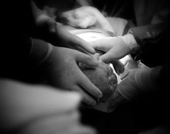 Black-and-white image of several gloved hands assisting in the delivery of a newborn during childbirth. The baby is partially out, surrounded by medical professionals in a dimly lit medical setting. The focus is on the baby's head and the supportive hands.