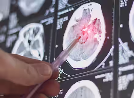 A hand holds a pen pointing at a brain scan image on a screen. The scan shows a highlighted red area, indicating a potential issue. The background displays multiple brain scan images in black and white tones.