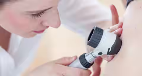 A close-up of a medical professional examining a patient's skin with a dermatoscope. The professional has light skin and brown hair tied back, focusing on the procedure, while the patient has a light skin tone. The scene is brightly lit and clinical.