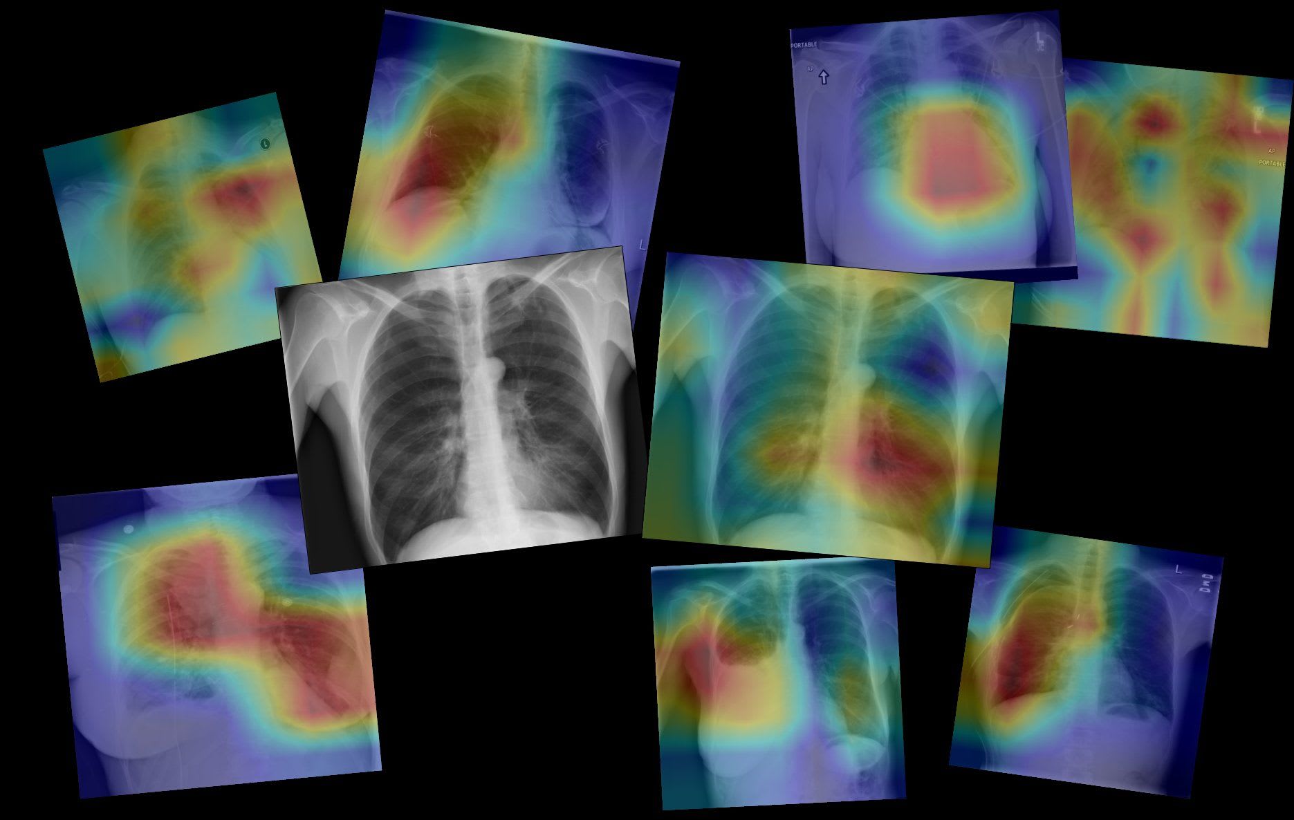 Coding a CNN for Medical Imaging using TensorFlow 2