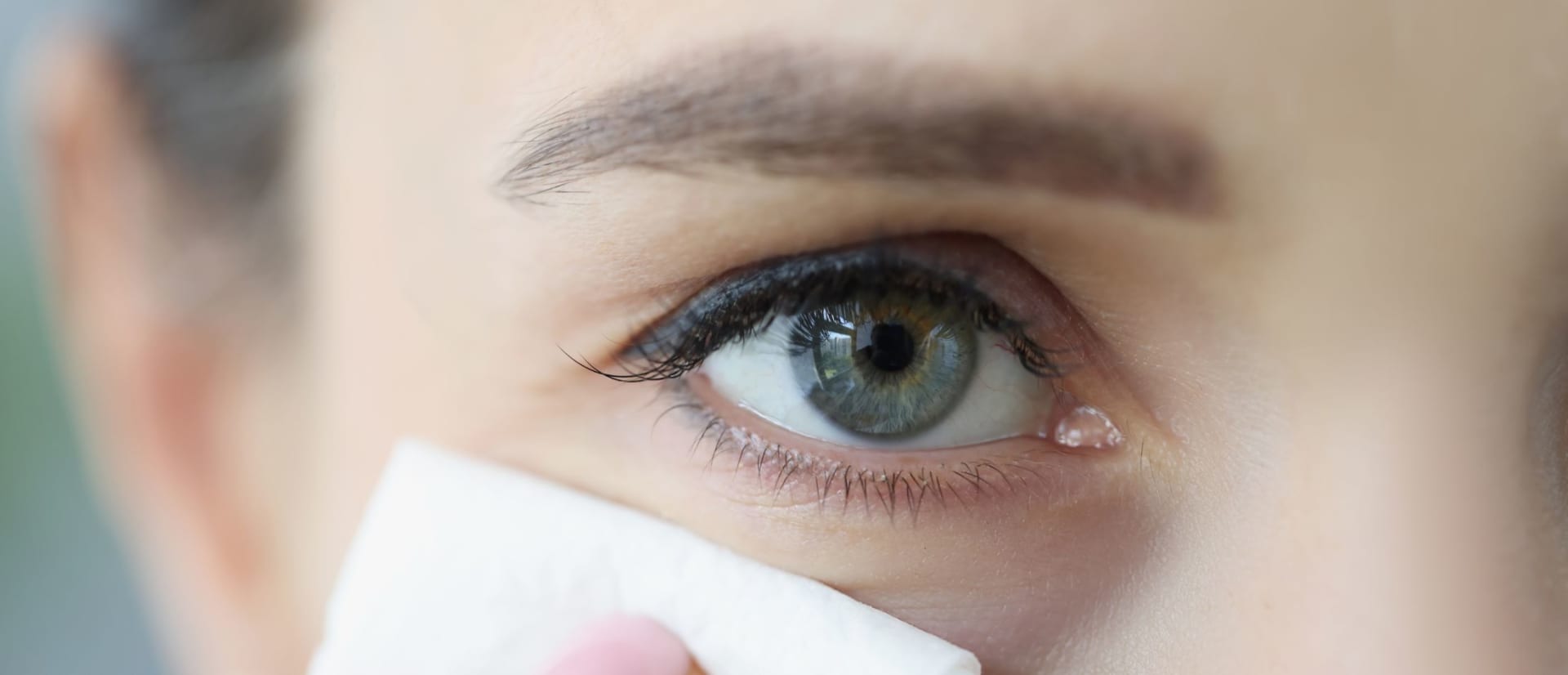 What is conjunctivitis?