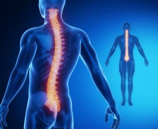 Stenoza spinalnog kanala lumbalnog segmenta, 1. dio klasifikacija i klinička slika