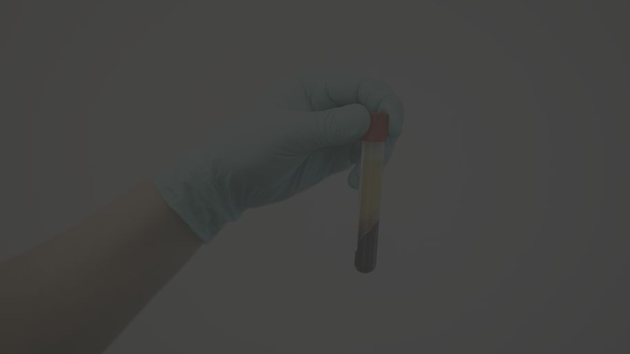 Gloved hand holding a blood sample vial.
