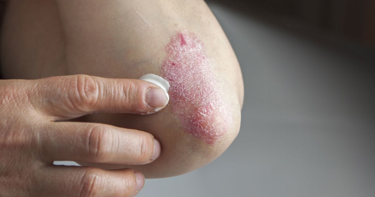 Skin problems shop