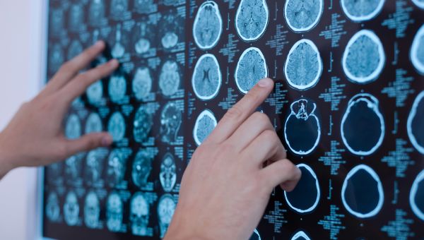 brain scans