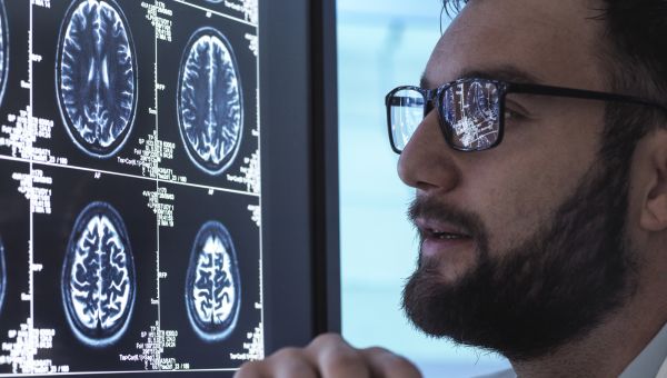 Doctor reading an MRI scan