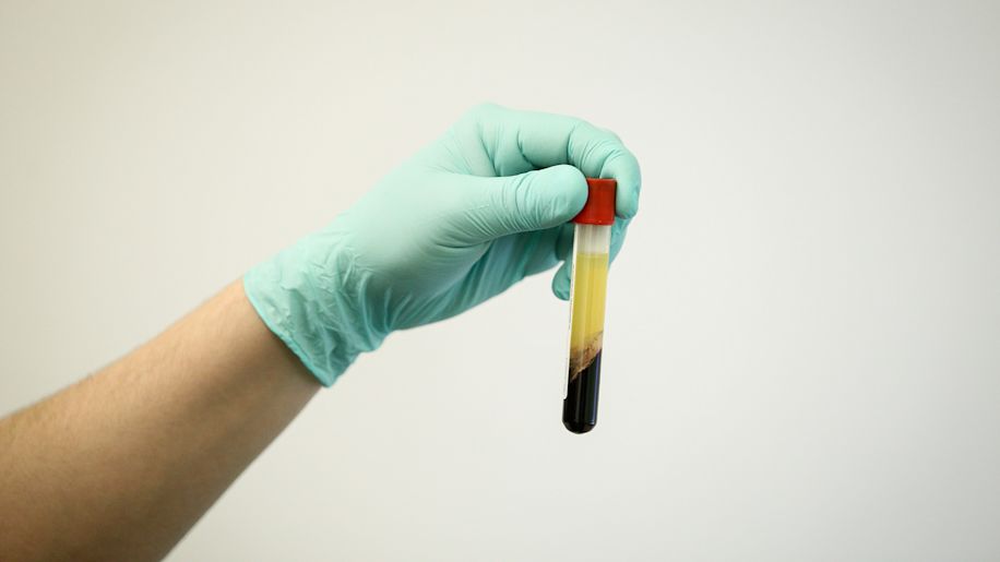 Gloved hand holding a blood sample vial.