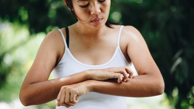 woman itching arm