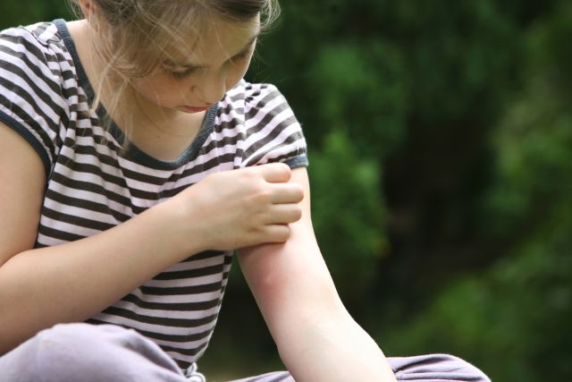 a little girl observes bug bite on her upper arm 