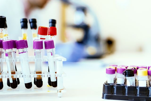 Molecular testing looks closely at the genetics and biology of cancer cells and can help your healthcare providers decide on the best approach to treating AML.