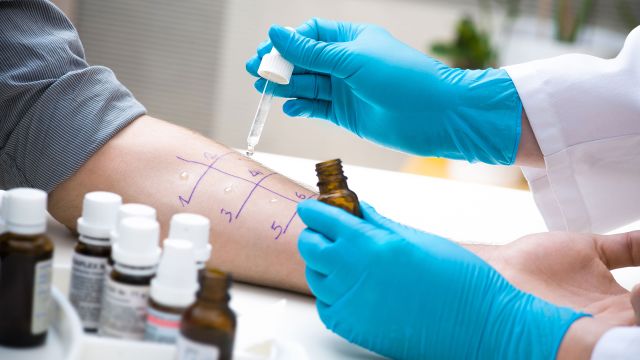 Close-up of person's arm getting an allergy test.