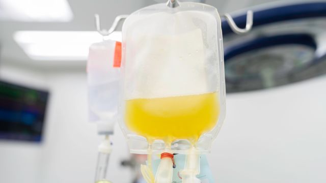 Intravenous plasma hangs on a medical IV stand. Plasma exchange is one potential treatment option for CIDP.
