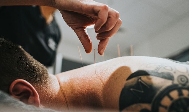 man with tattoo receiving acupuncture on upper back