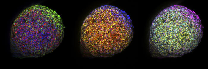 Lung stem cells cultured in the laboratory. The green, blue and purple colours emerging from behind the orbs are a protein expressed by lung basal stem cells. Picture: Clare Weeden, Walter and Eliza Hall Institute of Medical Research. 